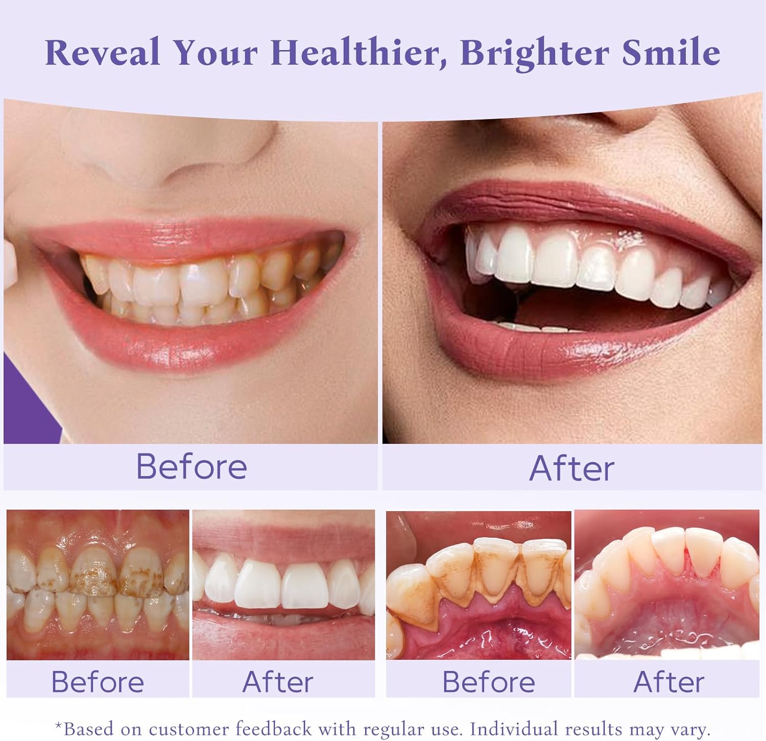 Teeth Whitening Powder,Remineralizing Hydroxyapatite Tooth Powder with Niacinamide